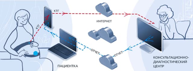 Монитор фетальный -Система дистанционного кардиотокографического мониторирования «ФМП» по ТУ 26.60.12-001-95560246-2019