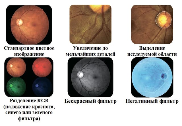 Фундус-камера офтальмологическая NFC-700